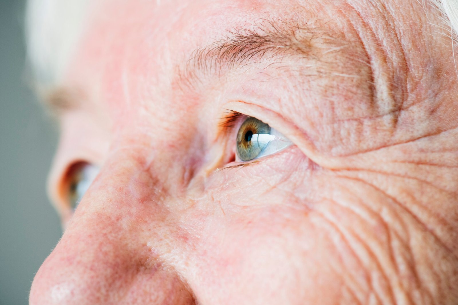 Représentation schématique d'un implant intraoculaire multifocal pour la chirurgie de la cataracte chez PremiumVision à Casablanca