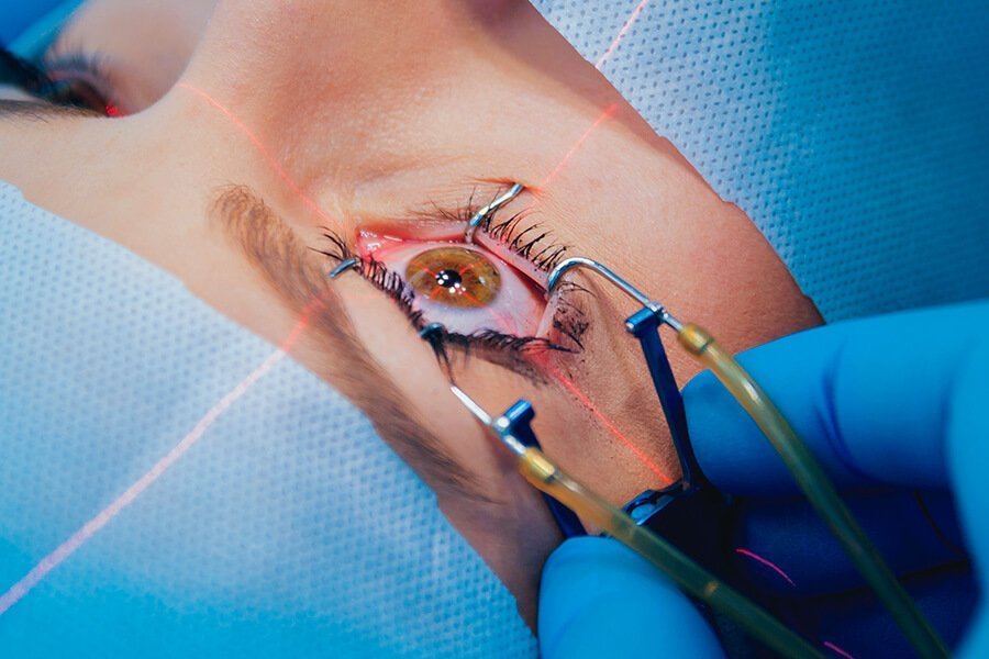Laser femtoseconde de haute précision utilisé pour la chirurgie Femto-LASIK chez PremiumVision à Casablanca